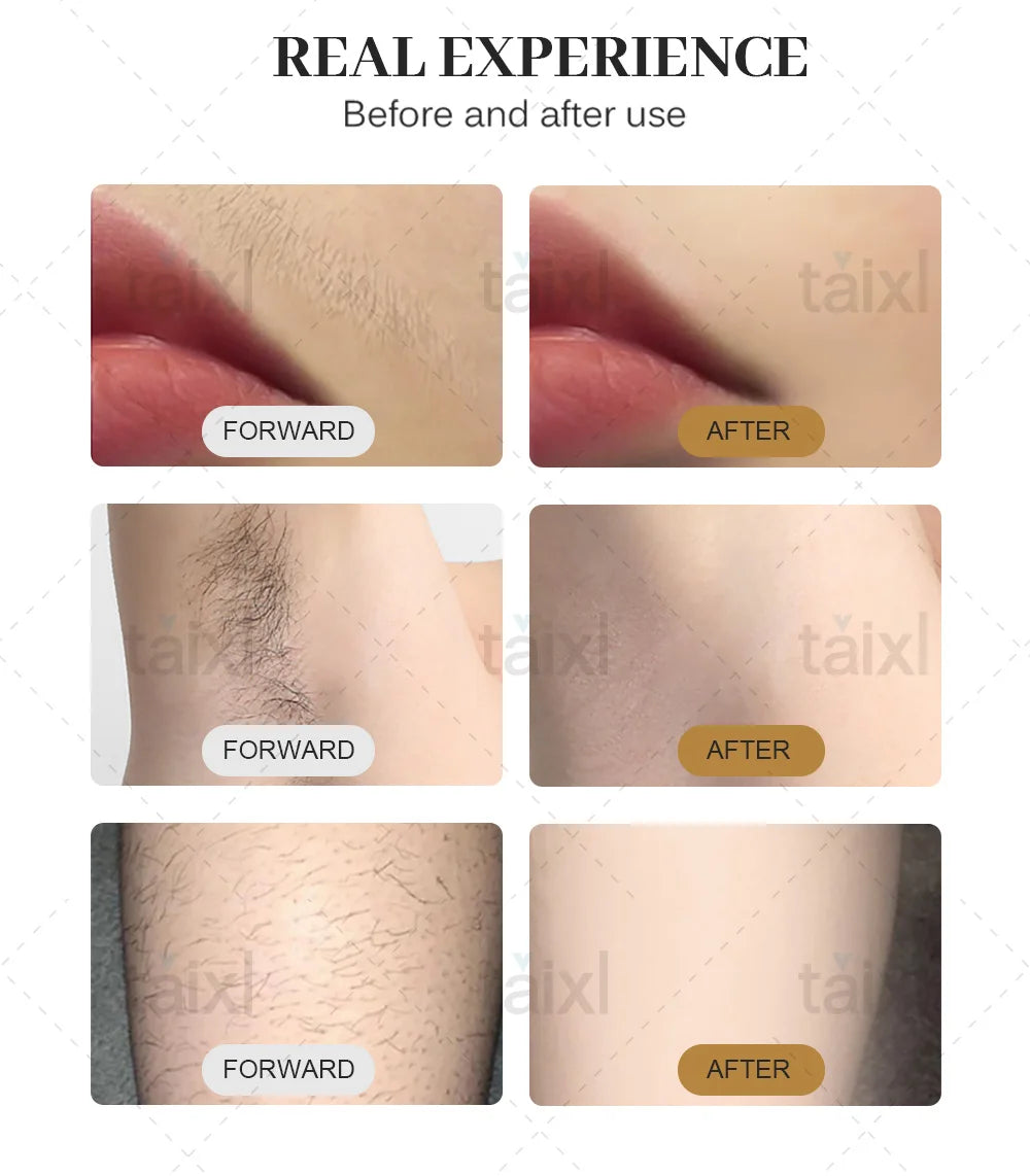 Portable Titanium laser And Soprano Ice Hair Removal System With A power of 4000W Designed For Professional Performance