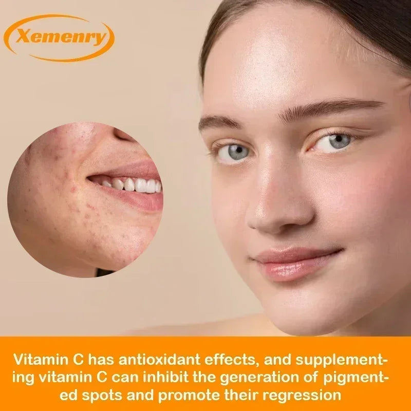 Vitamin C Capsules 1000mg - Immune System and Collagen Booster, Skin Health, Antioxidant Supplements