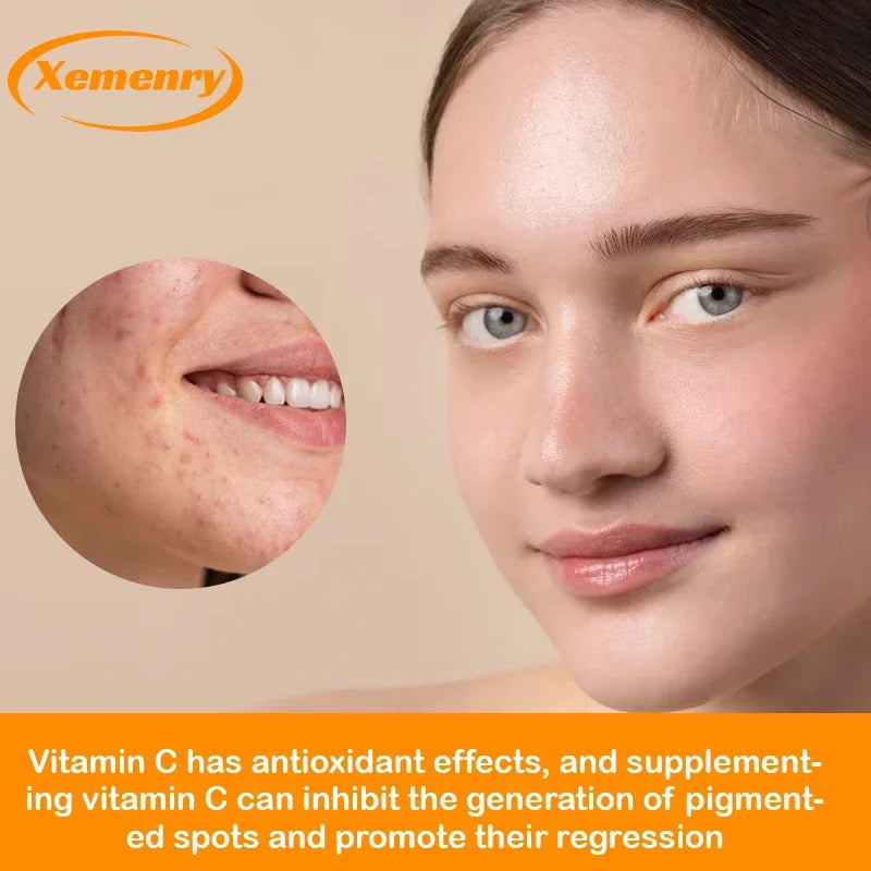 Vitamin C Capsules 1000mg - Immune System and Collagen Booster, Skin Health, Antioxidant Supplements