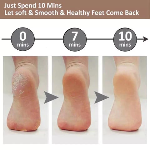 Electric Feet Callus Remover USB Rechargeable Electric Foot Grinder For Removing Dead Skin Feet Calluses Pedicure Care Tools